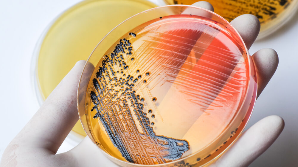 Swift Contamination How Quickly Can Bacterial Contamination Occur?